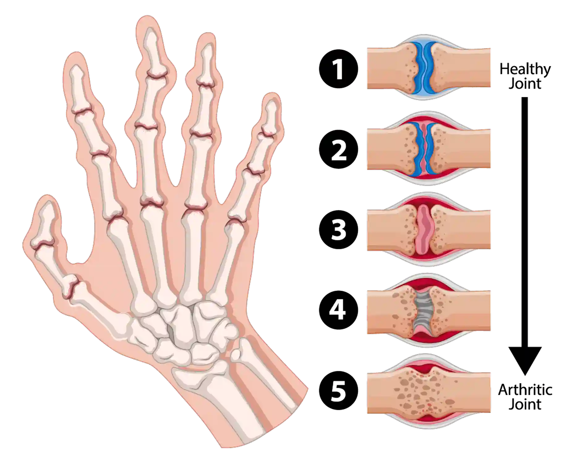 Rheumatology Billing and Coding Services